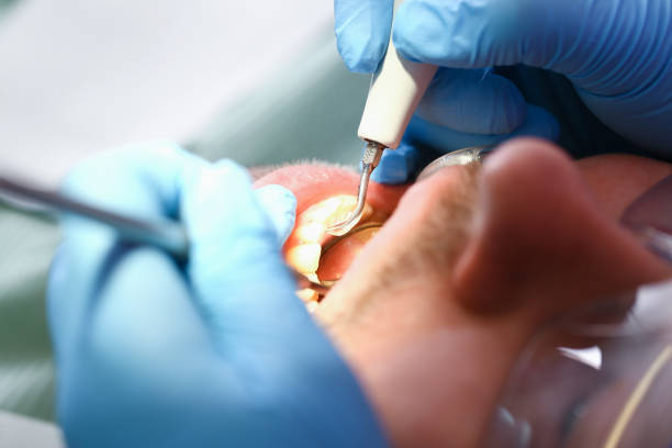 Best Emergency Treatment for Jaw Pain or Injury in Gonzalez, FL